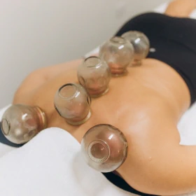 Cupping Therapy